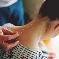 Scott Martin Acupuncture - Australian Directory 0