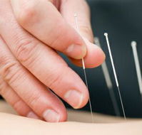Kingscliff Acupuncture  Massage - Australian Directory