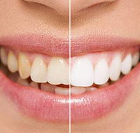 Newcastle Dental Care - Australian Directory