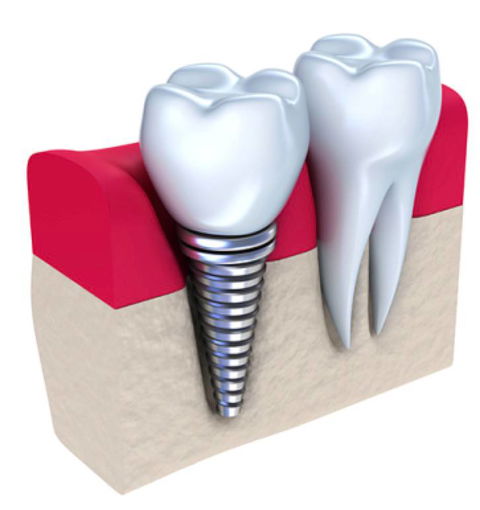 Honeysuckle Dental - Australian Directory 5