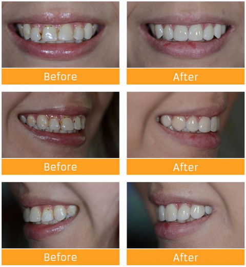 Honeysuckle Dental - Australian Directory 6