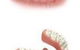 Precise Dentures–Blair Grundy Denture Clinic - thumb 2