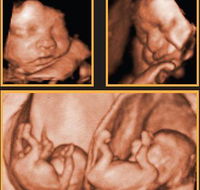 Sarina Medical Imaging - Australian Directory