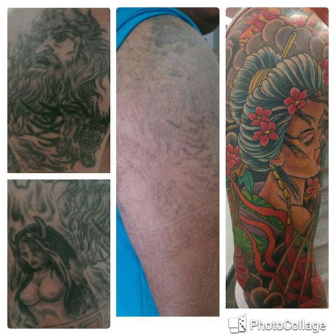 Laserpro Tattoo Removal - Australian Directory 0