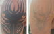 Laserpro Tattoo Removal - thumb 1